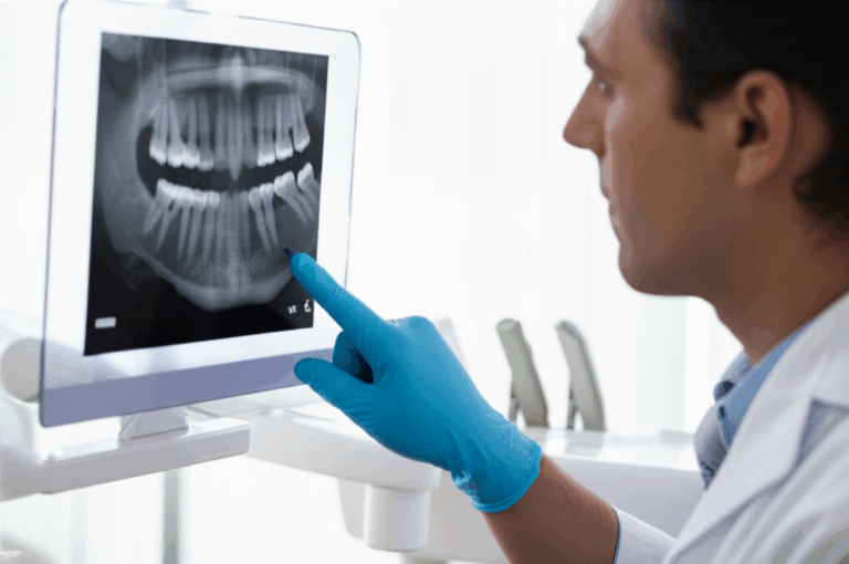 How Your Dentist Decides If You Need a Root Canal A Simple Guide