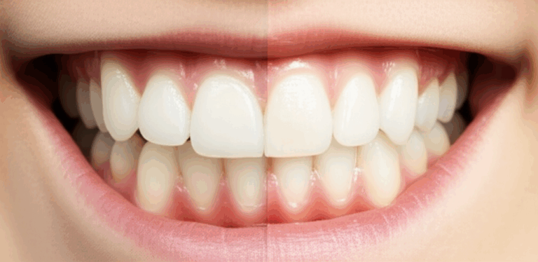 Is an Orthodontist a Dentist Understanding the Specialization in Oral Health