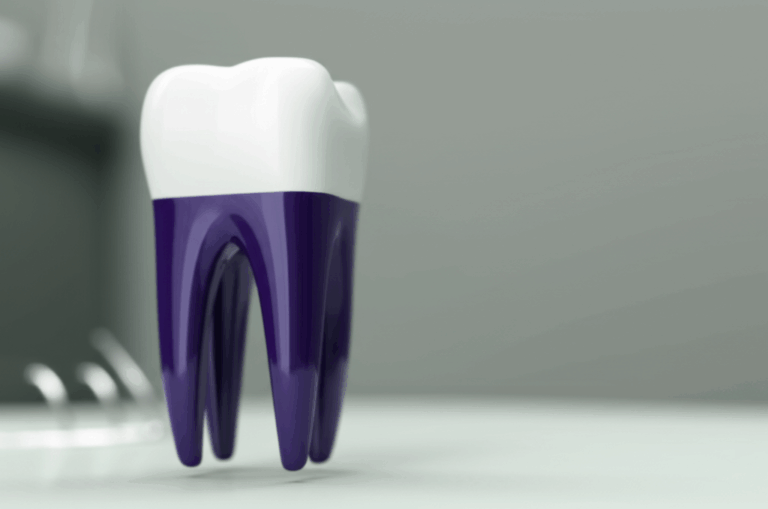 Should a Dentist Pay for a Failed Root Canal My Honest Guide After Experiencing It Myself
