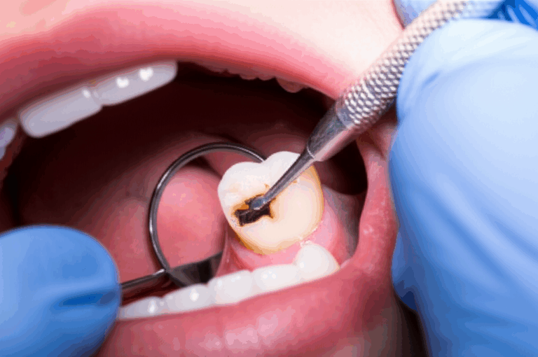 What Do Dentists Do for a Broken Tooth Your Friendly No Nonsense Guide to Repair and Restoration